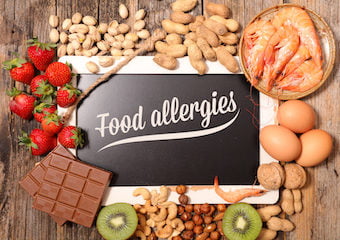 Food Allergy